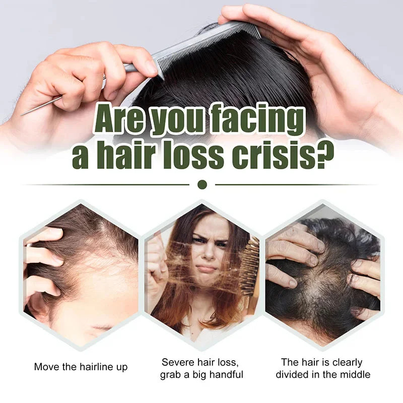 Fast Hair Growth Oil β Alopecia & Hair Loss Treatment Serum for Men and Women, 60ml