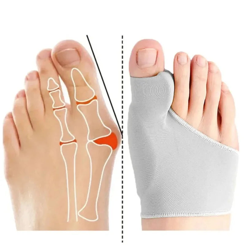 Toe Separator & Bunion Corrector – Hallux Valgus Orthotic Straightener