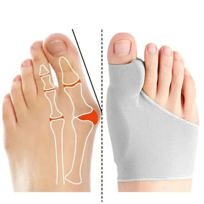 Toe Separator & Bunion Corrector – Hallux Valgus Orthotic Straightener