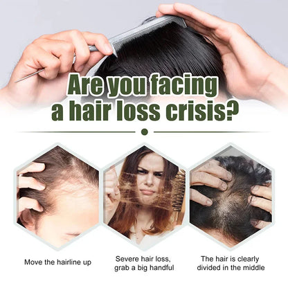 Fast Hair Growth Oil – Alopecia & Hair Loss Treatment Serum for Men and Women, 60ml