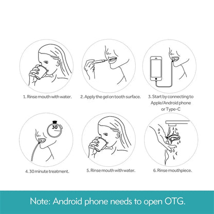 Teeth Whitening Accelerator – Smart LED Blue Light Portable Device with USB/iPhone/Android Charging