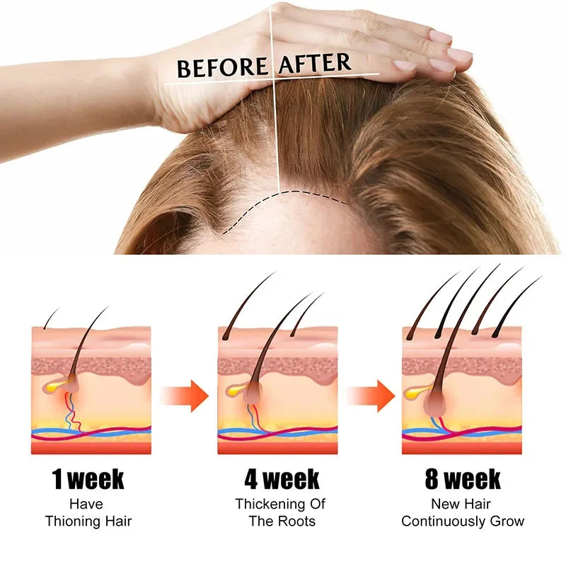 Fast Hair Growth Oil – Alopecia & Hair Loss Treatment Serum for Men and Women, 60ml